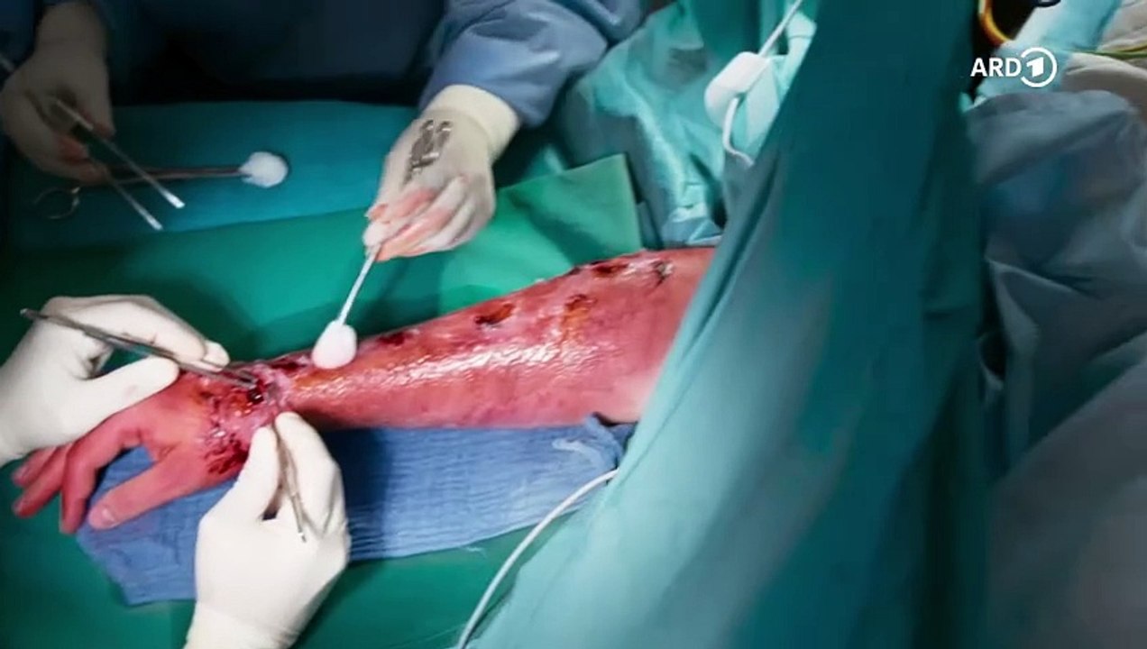 Schuldgefühle (374) - In aller Freundschaft – Die jungen Ärzte