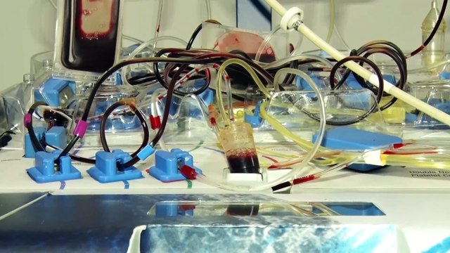 Se necesitan donantes escasez en las reservas en el Banco de Sangre del Hospital San Vicente Fundación Medellín 