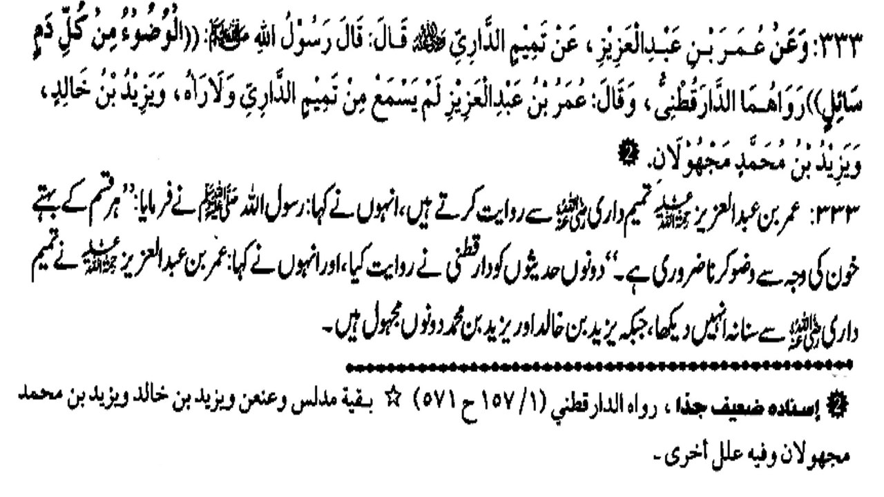 KYA BEHTY KHOON KI WAJA SE WAZU KARNA ZARORI HAI ? (333)