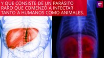 #OMG: Alerta por un parásito similar al cáncer que está surgiendo en Estados Unidos