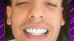 Natanael Cano se incrusta diamantes en los dientes y asi presume su nueva imagen