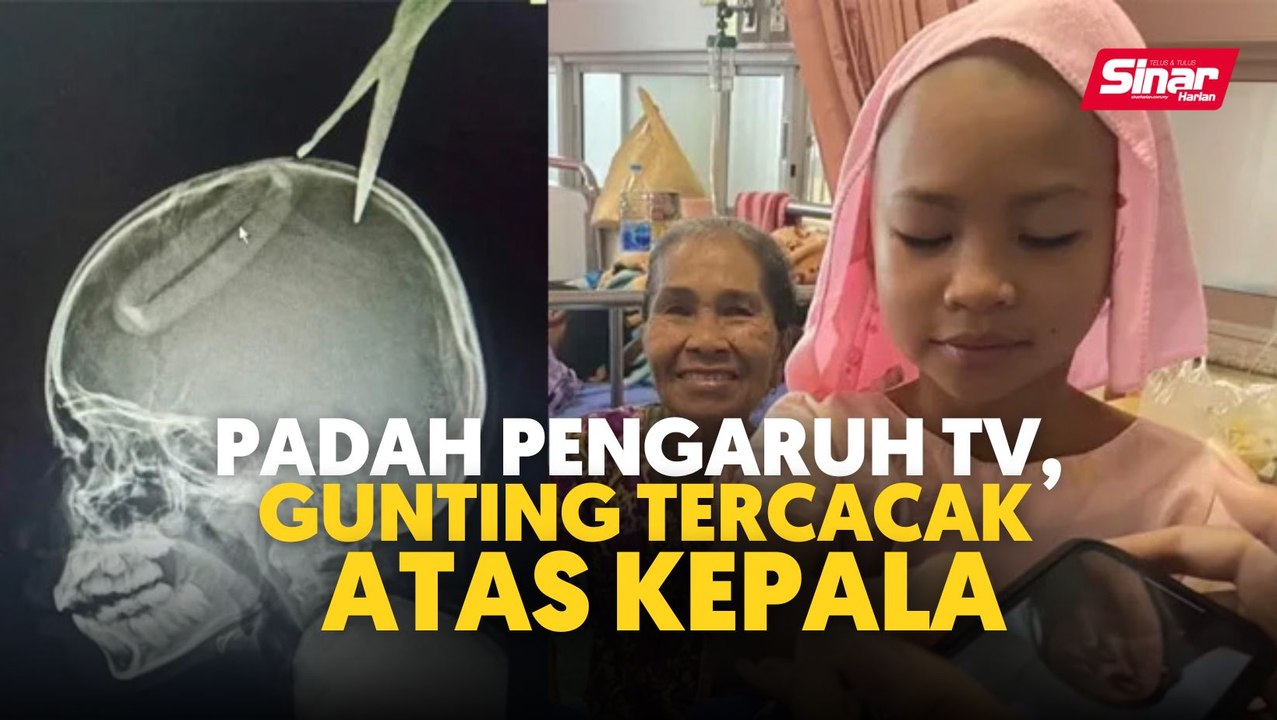 Padah pengaruh TV, gunting tercacak atas kepala