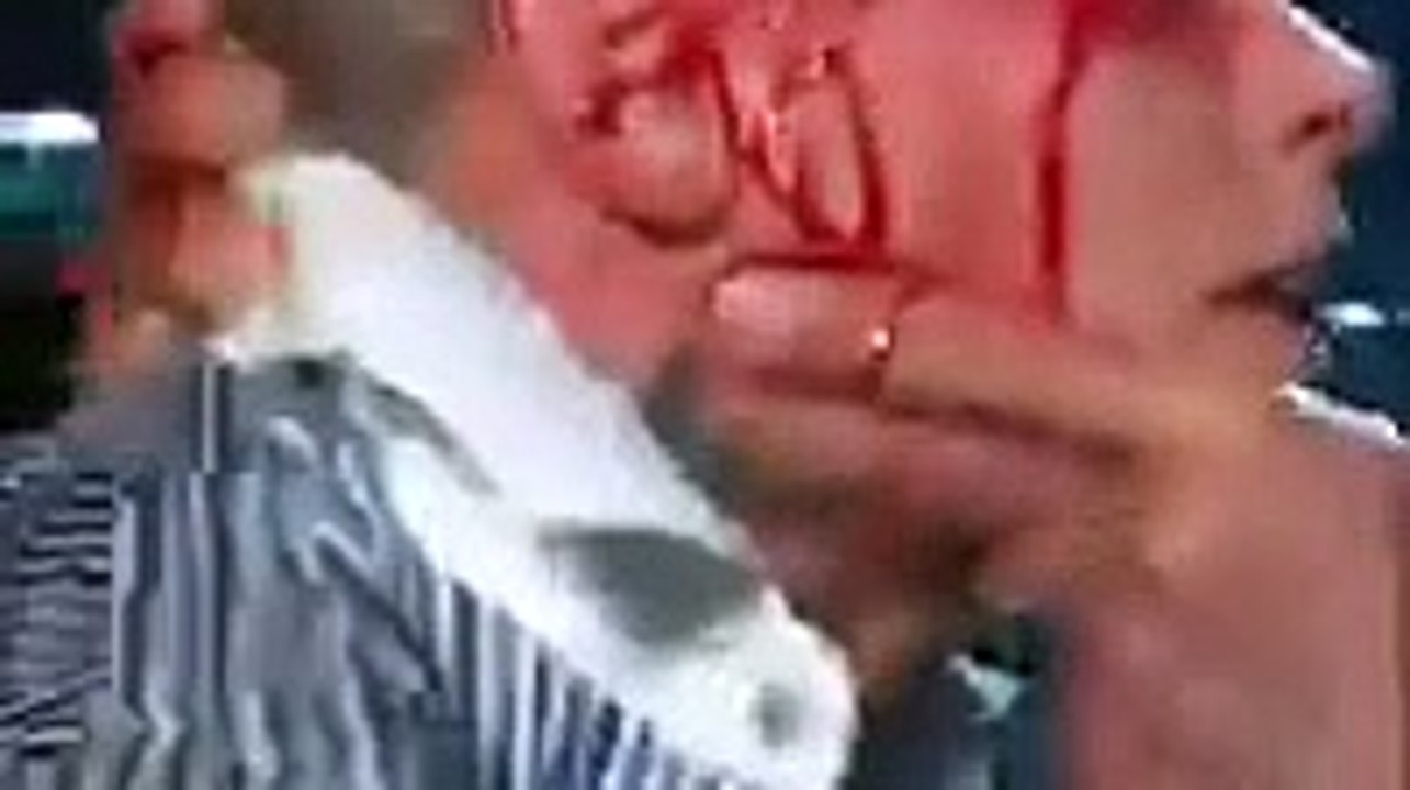 The Rock made Cody Rhodes bleed on WWE RAW 25 March 2024 Show