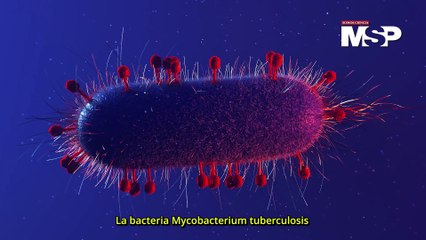 ¿Qué es la Tuberculosis y cómo actúa esta enfermedad bacteriana? - #EspecialMSP