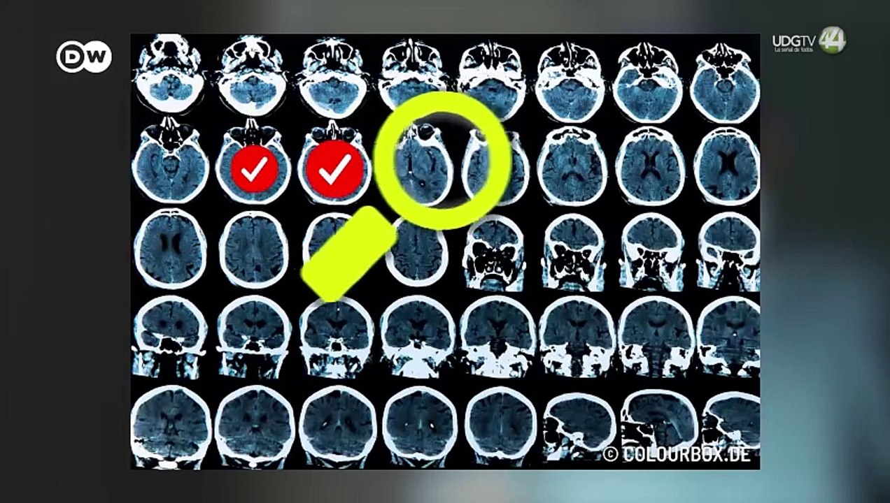 IA para detección oportuna de cánceres