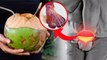 Uric Acid Me Nariyal Pani Pina Chahiye Ya Nahin| यूरिक एसिड में नारियल पानी पी सकते है | Boldsky