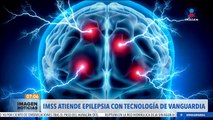 IMSS atiende a pacientes con epilepsia con tecnología de vanguardia