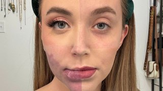 Woman born with facial birthmark slammed by trolls for choosing to lighten it