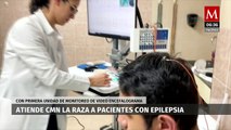IMSS ya cuenta con tecnología única para atención a pacientes con epilepsia
