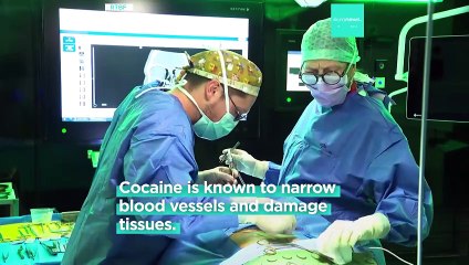 More people in Belgium need nose reconstruction due to cocaine use, doctors say