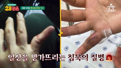 [예고] 소리 없는 뼈 도둑! 골다공증을 앓았던 그녀의 대변신