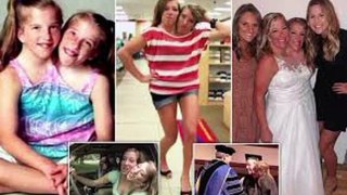 Abby and Brittany are conjoined twins who each have separate heads and share the same