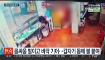 마약 후 몸에 불 지른 주유소 직원 전신 화상…