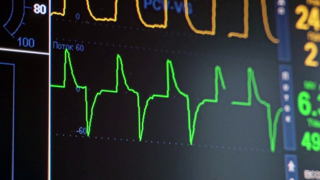 Health Insights Monitor Displaying Various Blood Pressure Readings