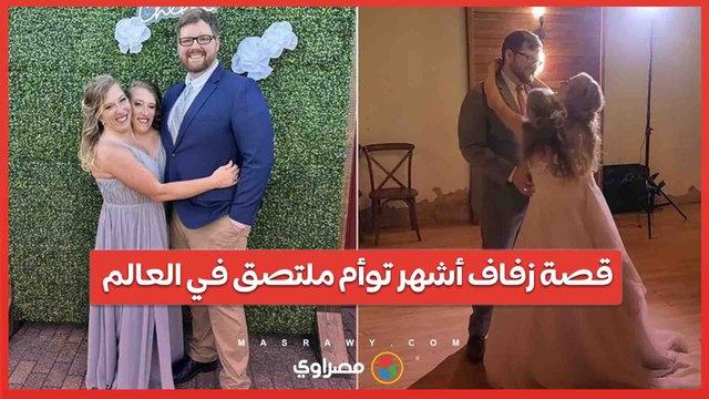 رأسان في جسد واحد .. قصة زفاف أشهر توأم ملتصق في العالم