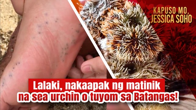 Lalaki, nakaapak ng matinik na sea urchin o tuyom sa Batangas! | Kapuso Mo, Jessica Soho