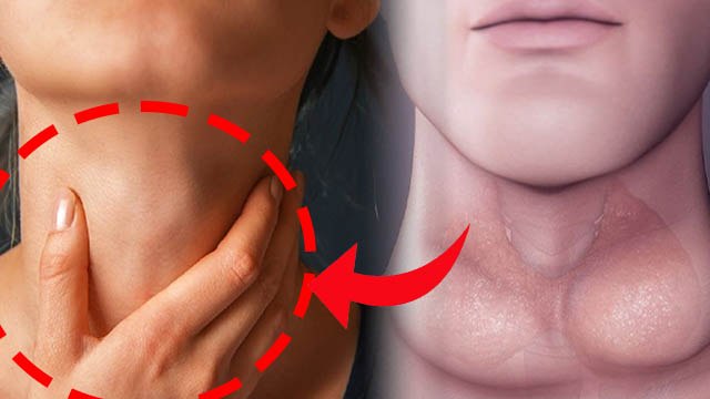 Hyperthyroidism And Hypothyroidism Difference | Hyperthyroidism Or Hypothyroidism Symptoms | Boldsky