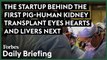 The Startup Behind The First Pig-Human Kidney Transplant 'Eyes' Hearts And Livers Next
