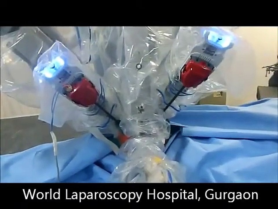 da Vinci Nephrectomy
