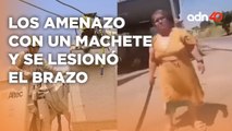 Ni el machete pudo contra el karma, una mujer amenazo a trabajadores de la CFE y sufrió una lesión