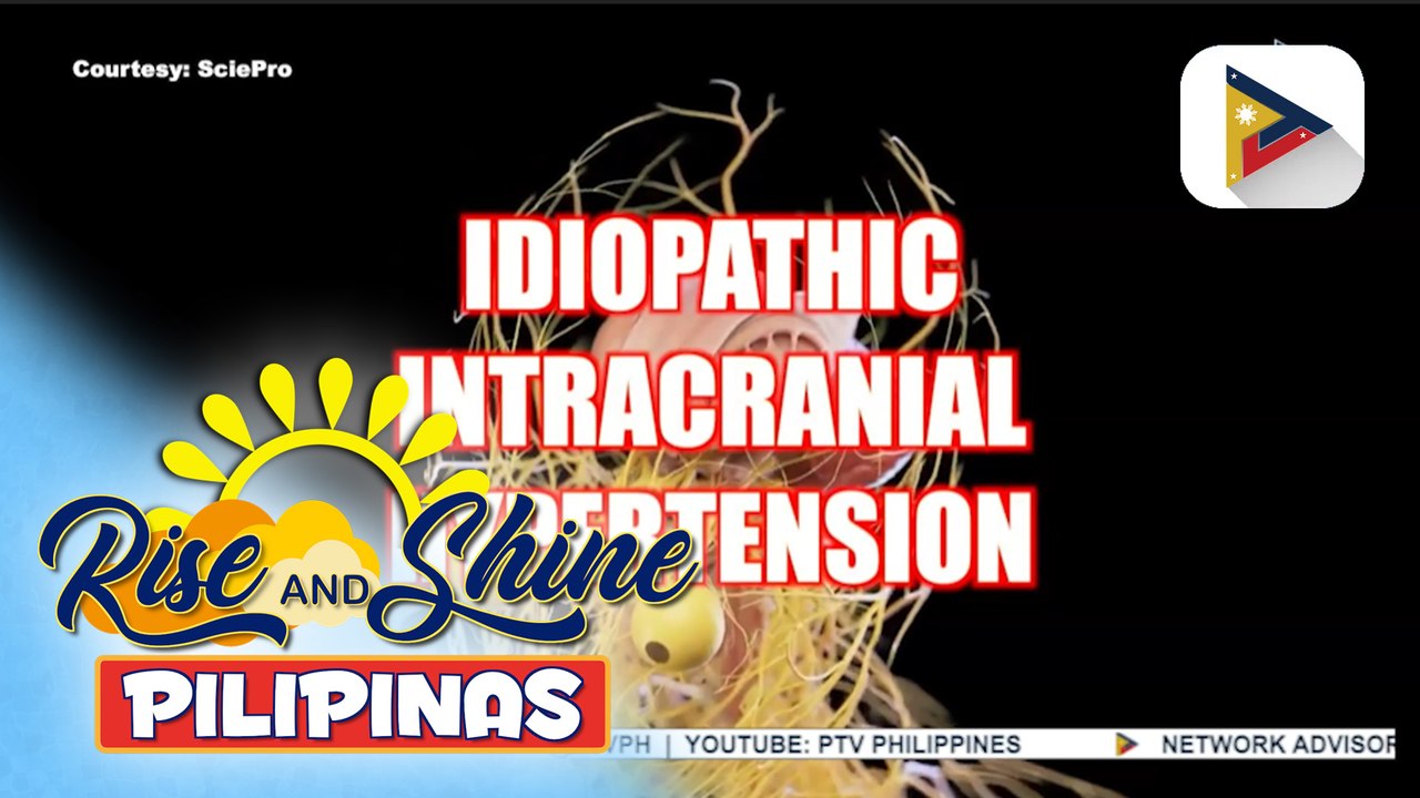 SAY ni DOK | Ano nga ba ang sakit na idiopathic intracranial hypertension at paano ba ito maiiwasan?
