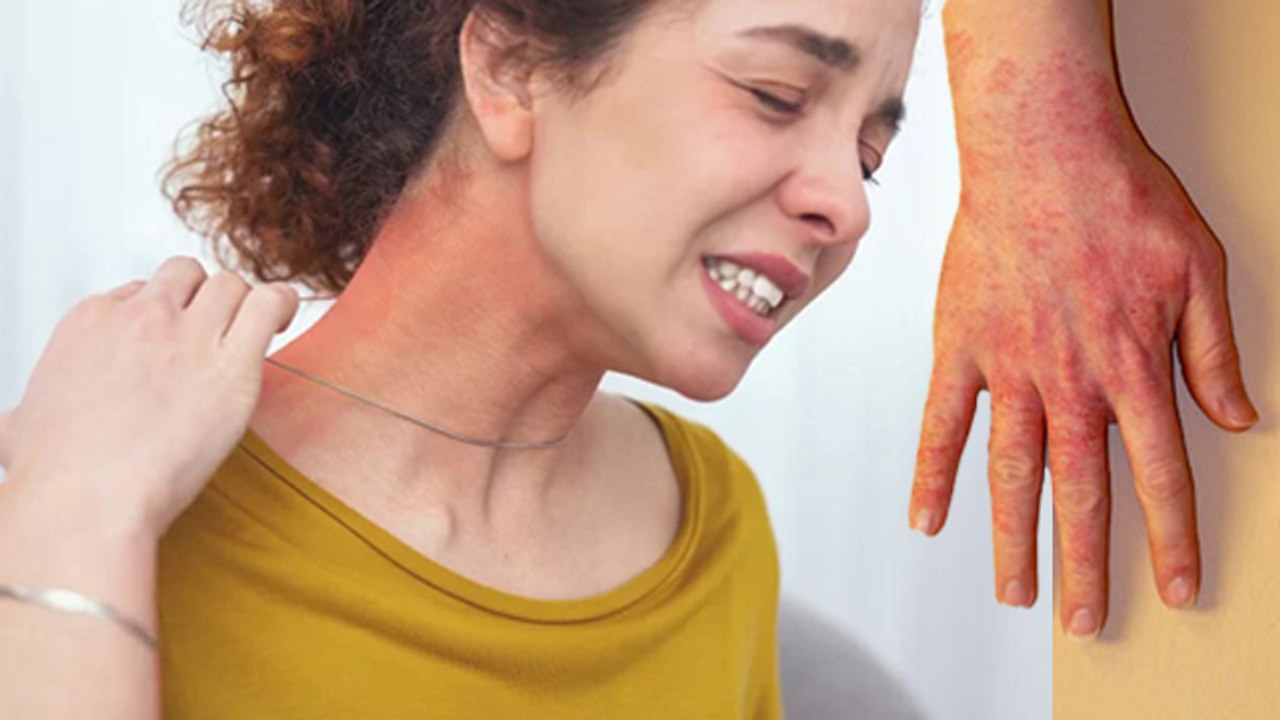 Gold Jewellery से Allergy होने का कारण | Gold Jewellery Skin Allergy Symptoms | Right Gold For Skin