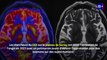 Premières images du cerveau humain obtenues par l'IRM le plus puissant du monde