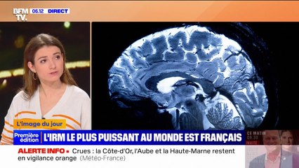 Le cerveau comme vous ne l'avez jamais vu: l'IRM la plus puissante au monde a été dévoilée