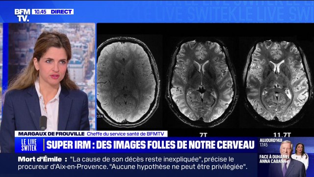 L'IRM le plus puissant du monde dévoile des images folles de notre cerveau