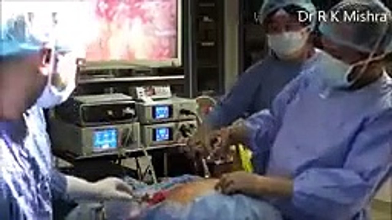 Sleeve Gastrectomy in Patient Previously operated for Ventral Hernia