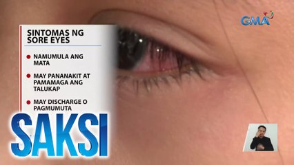 Sore eyes, karaniwang sakit ngayong tag-init; payo ng doktor: 'wag mag-self medicate | Saksi