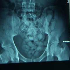 Le ventre rempli de poudre blanche