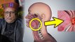 Sushil Modi Throat Cancer Update: Symptoms, Treatment, Reasons In Hindi, Survival Rate | Boldsky