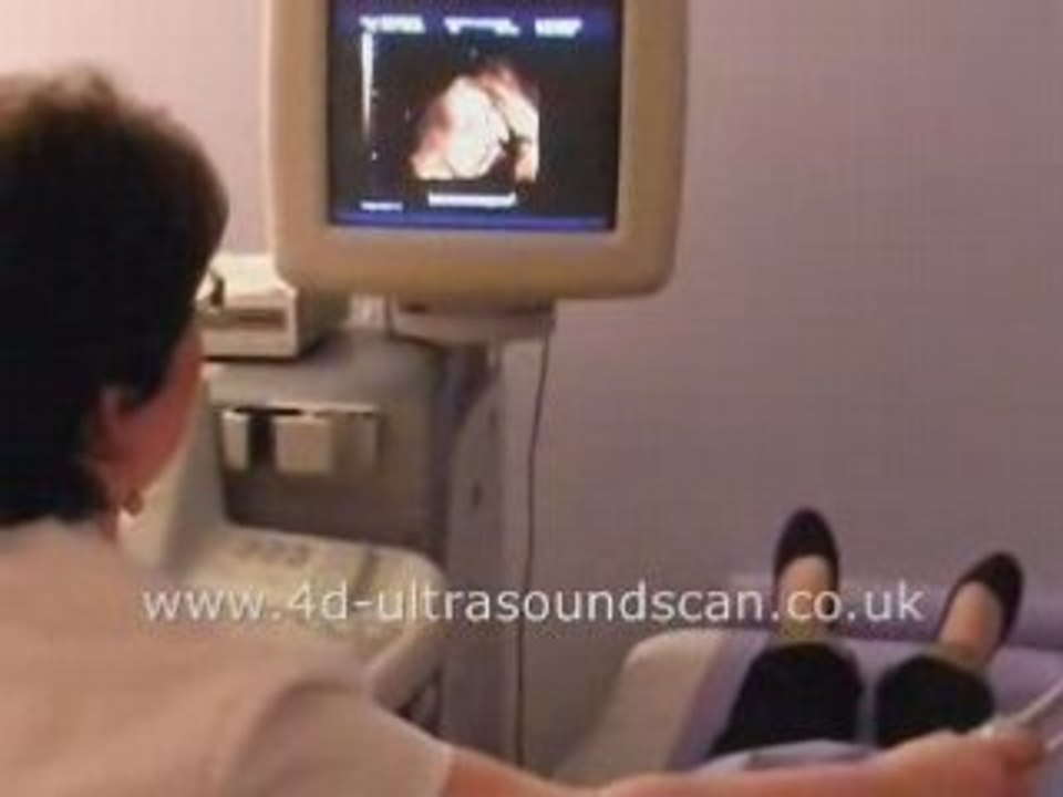 Wonderful 4D Baby Scans Video
