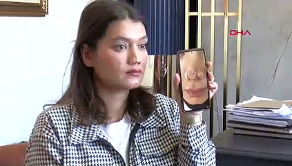Yine bir estetik davası: Genç kadın 1 milyon TL'lik dava açtı