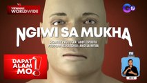 Ano ang dahilan ng pagkakaroon ng Bell’s Palsy? | Dapat Alam Mo!