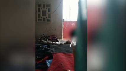 CENAS FORTES: adolescente é queimada com água fervente e agredida pela própria tia 