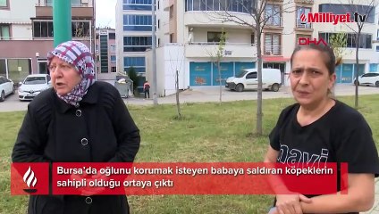 30 dikiş atıldı, çenesi kırıldı! Dehşete düşüren olayda köpekler sahipli çıktı