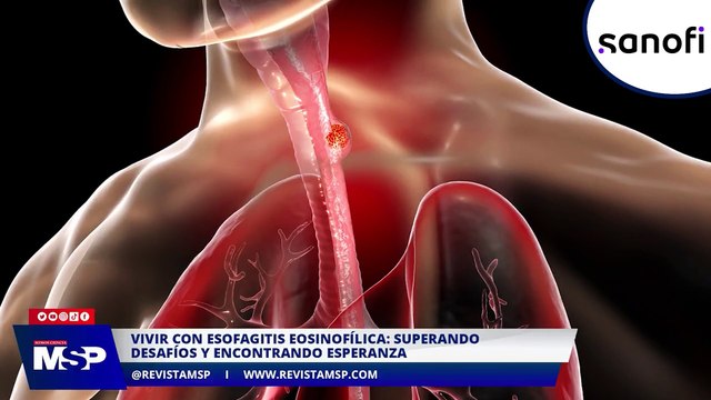 ¿Cómo es vivir con esofagitis eosinofílica? Testimonio de un paciente - #ExclusivoMSP