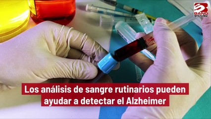 Los análisis de sangre rutinarios pueden ayudar a detectar el Alzheimer