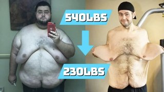 Losing 300lbs Left Me With Extreme Saggy Skin | BRAND NEW ME
