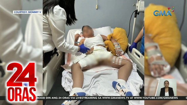 Ospital kung saan nabanlian ng mainit na tubig ang 9-anyos na pasyente, sinampahan ng reklamo | 24 Oras