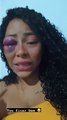Com olho roxo, mulher denuncia que foi agredida por namorado