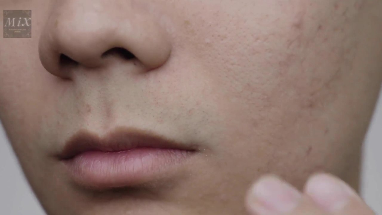 Large pores Myths | Ways to Avoid Large pores #mix #beauty #large_pores