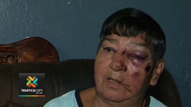 tn7-adulta-mayor-cuenta-momentos-de-terror-tras-encuentro-con-toro-110424