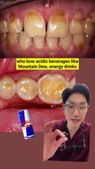 Did you know acidic foods can erode and melt your teeth away?