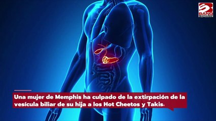 Mujer culpa a los Cheetos de la extirpación de la vesícula biliar de su hija