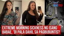 Extreme morning sickness ng isang babae, 'di pala dahil sa pagbubuntis?! | GMA Integrated Newsfeed