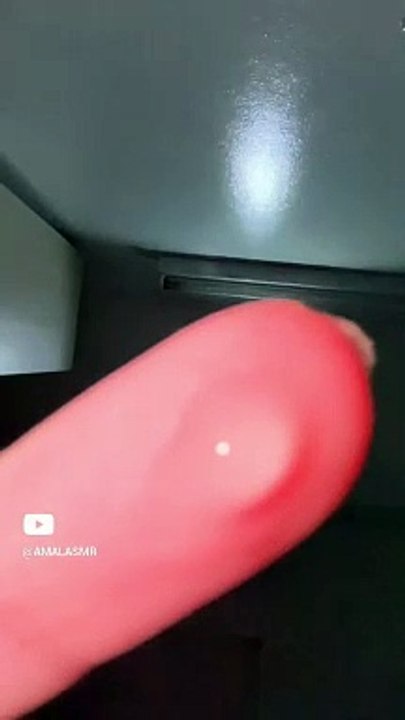 Eye