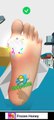 Foot Clinic - ASMR Feet Care (part 7) ll Ayak Kliniği __ Ayak Bakımı